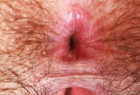 ATK hairy Kyra Rose Set