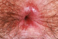 ATK hairy Kyra Rose Set