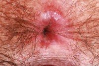 ATK hairy Kyra Rose in hairy fun