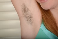 ATK hairy  in young and hairy