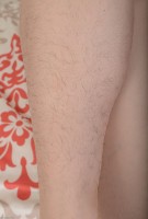 ATK hairy  in young and hairy