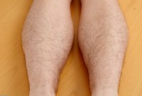 ATK hairy  in young and hairy