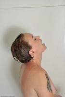 ATK hairy  in young and hairy