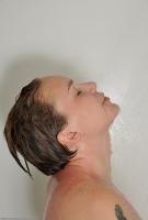 ATK hairy  in young and hairy