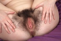 ATK hairy  in young and hairy