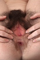 ATK hairy  in young and hairy