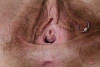 ATK hairy  in young and hairy
