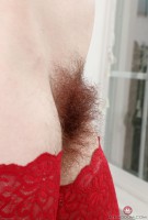 ATK hairy  in young and hairy