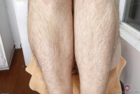 ATK hairy  in young and hairy