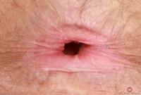 ATK hairy Lauren Laurent Set