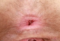 ATK hairy Lauren Laurent Set