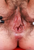 ATK hairy  in young and hairy