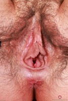 ATK hairy  in young and hairy