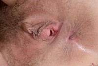 ATK hairy  in mature and hairy