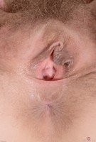 ATK hairy  in mature and hairy