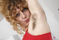 ATK hairy  in mature and hairy