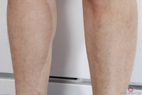 ATK hairy  in mature and hairy