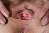 ATK hairy  in mature and hairy