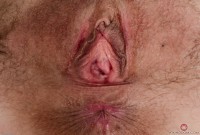 ATK hairy  in mature and hairy