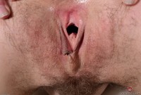 ATK hairy  in mature and hairy