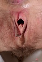 ATK hairy  in mature and hairy