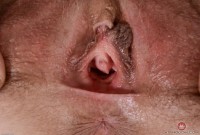 ATK hairy  in mature and hairy