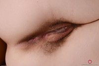 ATK hairy  in mature and hairy