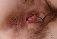 ATK hairy  in mature and hairy