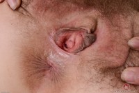 ATK hairy  in mature and hairy