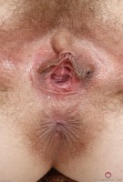 ATK hairy  in mature and hairy