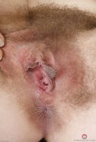 ATK hairy  in mature and hairy