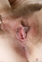 ATK hairy  in mature and hairy