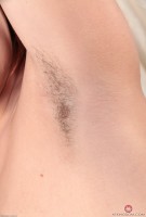 ATK hairy  in young and hairy