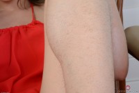 ATK hairy  in young and hairy