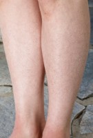 ATK hairy Lily LaBeau Set