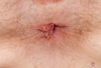 ATK hairy  in young and hairy