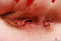 ATK hairy  in young and hairy