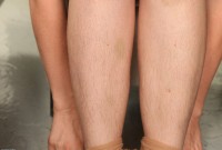 ATK hairy Lindsey Set