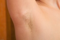 ATK hairy  in young and hairy