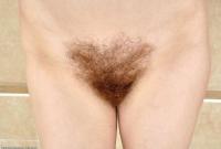 ATK hairy  in mature and hairy