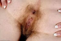 ATK hairy  in mature and hairy