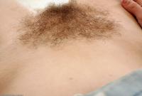 ATK hairy  in mature and hairy