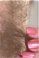 ATK hairy  in mature and hairy