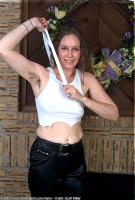 ATK hairy  in mature and hairy