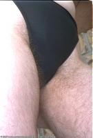 ATK hairy  in mature and hairy