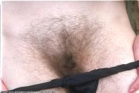 ATK hairy  in mature and hairy