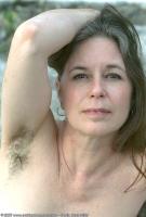ATK hairy  in mature and hairy