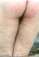 ATK hairy  in mature and hairy