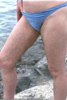 ATK hairy  in mature and hairy