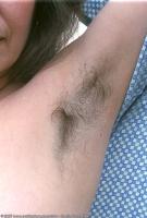 ATK hairy  in mature and hairy